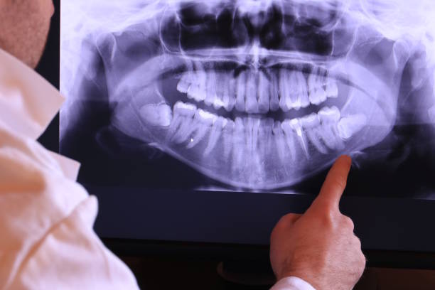 Best Emergency Root Canal Treatment in Little Elm, TX