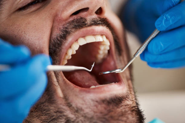 Best Walk-In Emergency Dentist in Little Elm, TX
