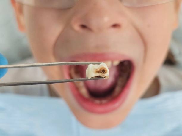 Best Pediatric Emergency Dentist in Little Elm, TX